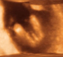 18 недель мальчик. 3д УЗИ на 13 неделе беременности. 3д УЗИ беременности пол.